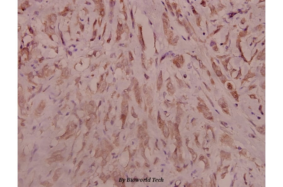 Anti-Trk B (D699) Antibody from Bioworld Technology (BS3668) - Antibodies.com