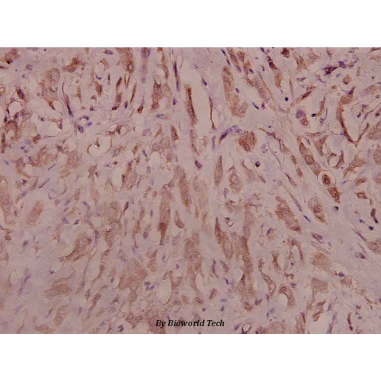 Anti-Trk B (D699) Antibody from Bioworld Technology (BS3668) - Antibodies.com
