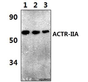 Anti-ACTR-IIA (H59) Antibody from Bioworld Technology (BS3669) - Antibodies.com