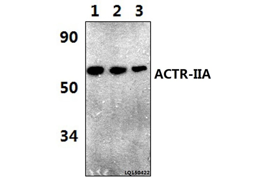 Anti-ACTR-IIA (H59) Antibody from Bioworld Technology (BS3669) - Antibodies.com