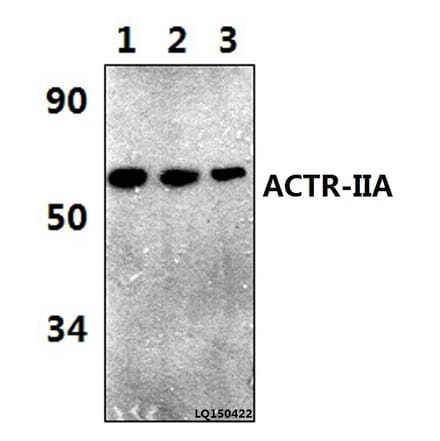 Anti-ACTR-IIA (H59) Antibody from Bioworld Technology (BS3669) - Antibodies.com