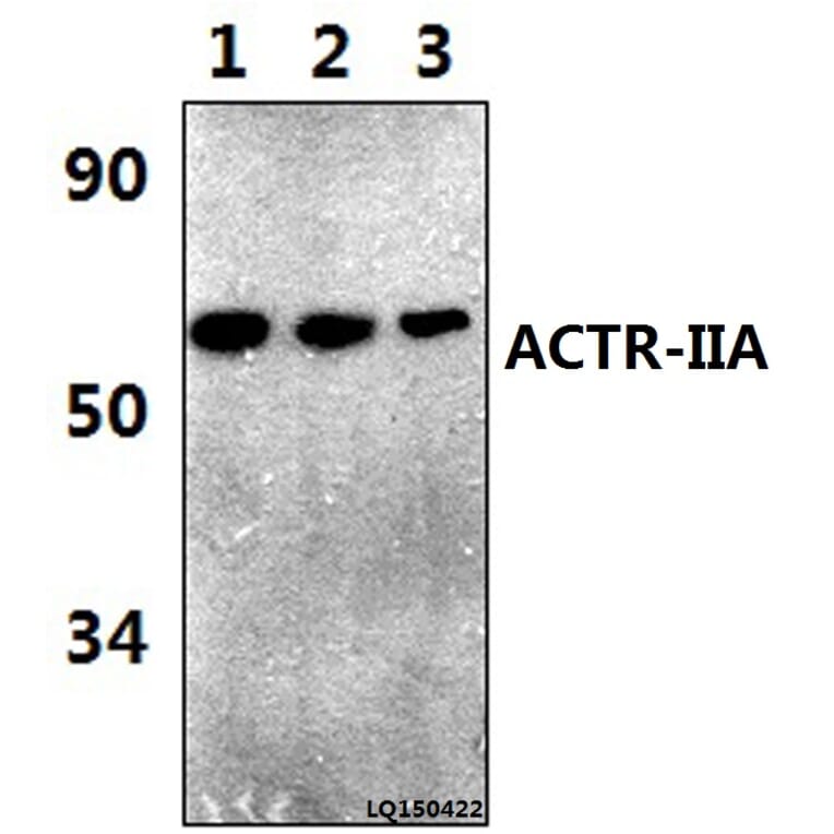Anti-ACTR-IIA (H59) Antibody from Bioworld Technology (BS3669) - Antibodies.com