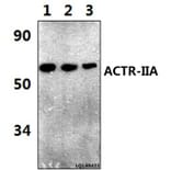 Anti-ACTR-IIA (H59) Antibody from Bioworld Technology (BS3669) - Antibodies.com