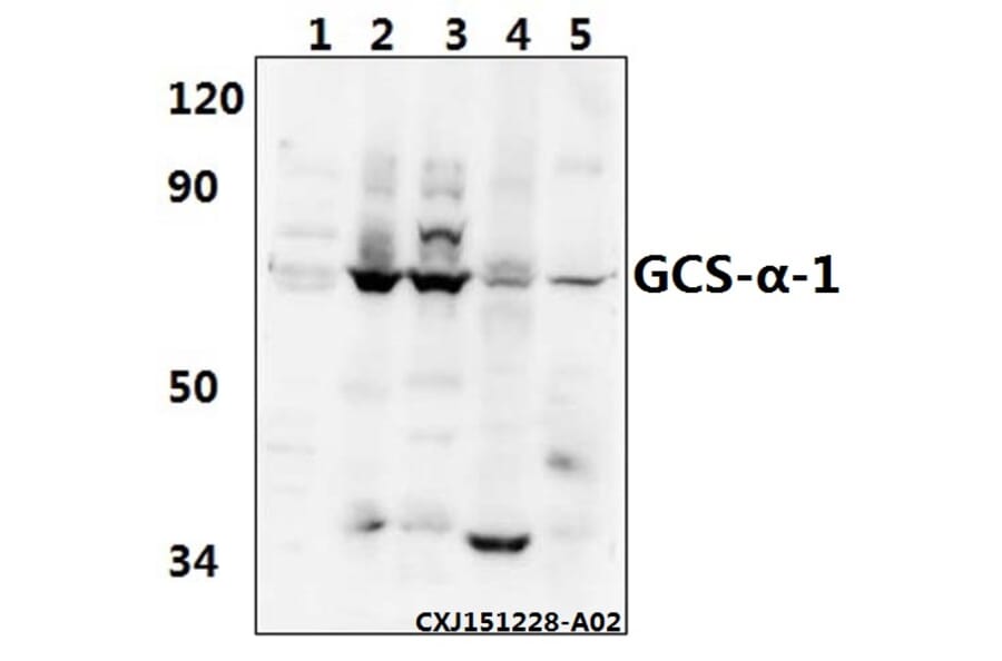 Anti-GCS-α-1 (D423) Antibody from Bioworld Technology (BS3670) - Antibodies.com