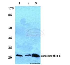Anti-Cardiotrophin-1 (H31) Antibody from Bioworld Technology (BS3672) - Antibodies.com