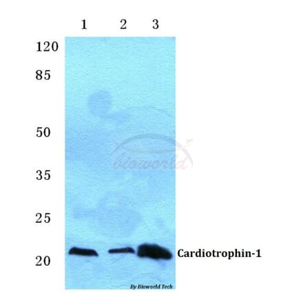 Anti-Cardiotrophin-1 (H31) Antibody from Bioworld Technology (BS3672) - Antibodies.com