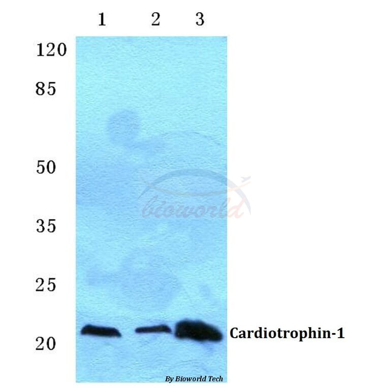 Anti-Cardiotrophin-1 (H31) Antibody from Bioworld Technology (BS3672) - Antibodies.com