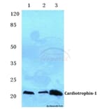 Anti-Cardiotrophin-1 (H31) Antibody from Bioworld Technology (BS3672) - Antibodies.com