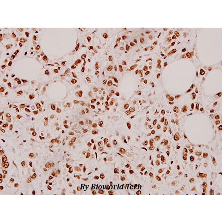 Anti-Cardiotrophin-1 (H31) Antibody from Bioworld Technology (BS3672) - Antibodies.com