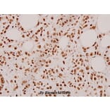 Anti-Cardiotrophin-1 (H31) Antibody from Bioworld Technology (BS3672) - Antibodies.com