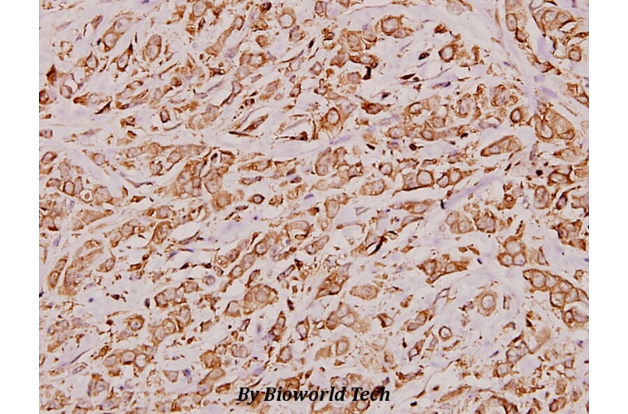 Anti-Cathepsin D (K345) Antibody from Bioworld Technology (BS3673) - Antibodies.com