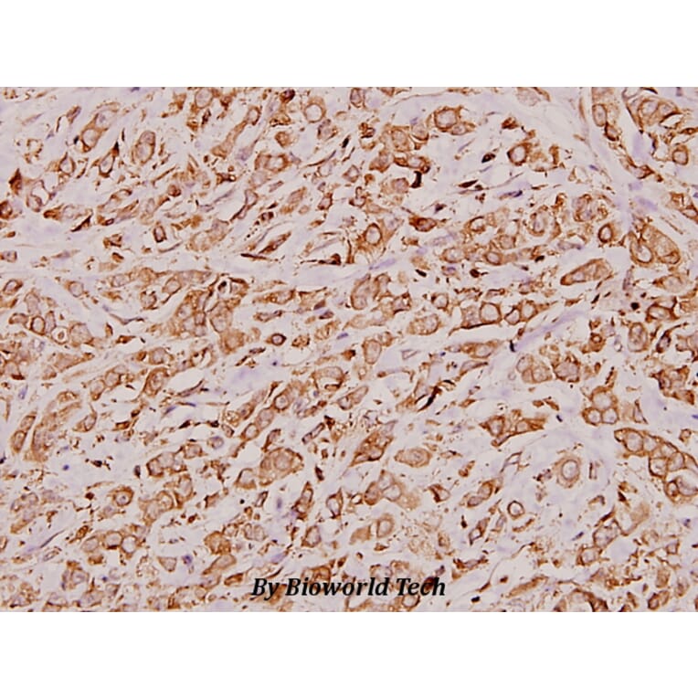 Anti-Cathepsin D (K345) Antibody from Bioworld Technology (BS3673) - Antibodies.com