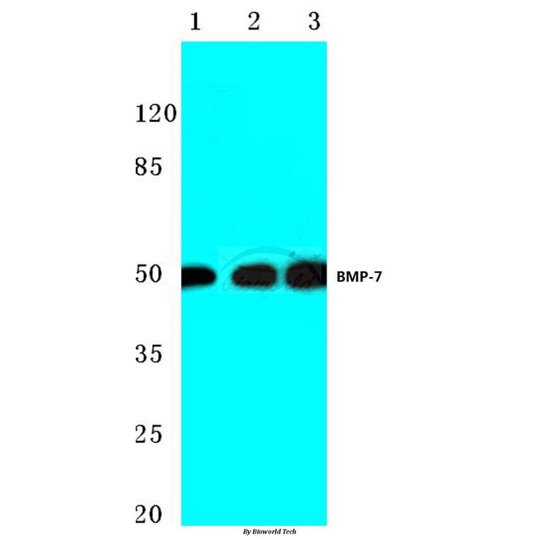 Anti-BMP-7 (E173) Antibody from Bioworld Technology (BS3674) - Antibodies.com