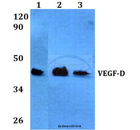 Anti-VEGF-D (I202) Antibody from Bioworld Technology (BS3675) - Antibodies.com