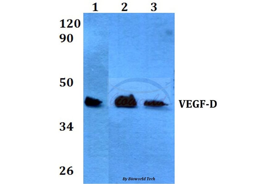 Anti-VEGF-D (I202) Antibody from Bioworld Technology (BS3675) - Antibodies.com