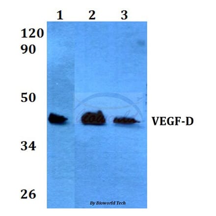 Anti-VEGF-D (I202) Antibody from Bioworld Technology (BS3675) - Antibodies.com
