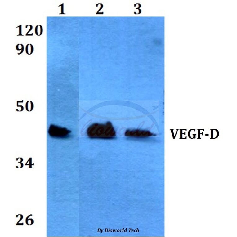 Anti-VEGF-D (I202) Antibody from Bioworld Technology (BS3675) - Antibodies.com