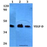 Anti-VEGF-D (I202) Antibody from Bioworld Technology (BS3675) - Antibodies.com