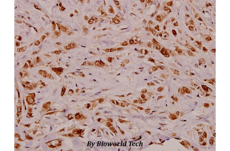 Anti-VEGF-D (I202) Antibody from Bioworld Technology (BS3675) - Antibodies.com