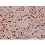 Anti-VEGF-D (I202) Antibody from Bioworld Technology (BS3675) - Antibodies.com