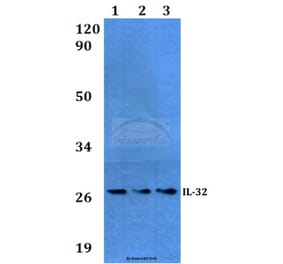 Anti-IL-32 (K226) Antibody from Bioworld Technology (BS3676) - Antibodies.com