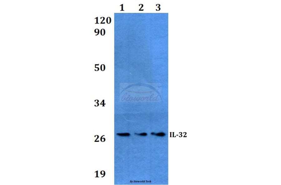 Anti-IL-32 (K226) Antibody from Bioworld Technology (BS3676) - Antibodies.com