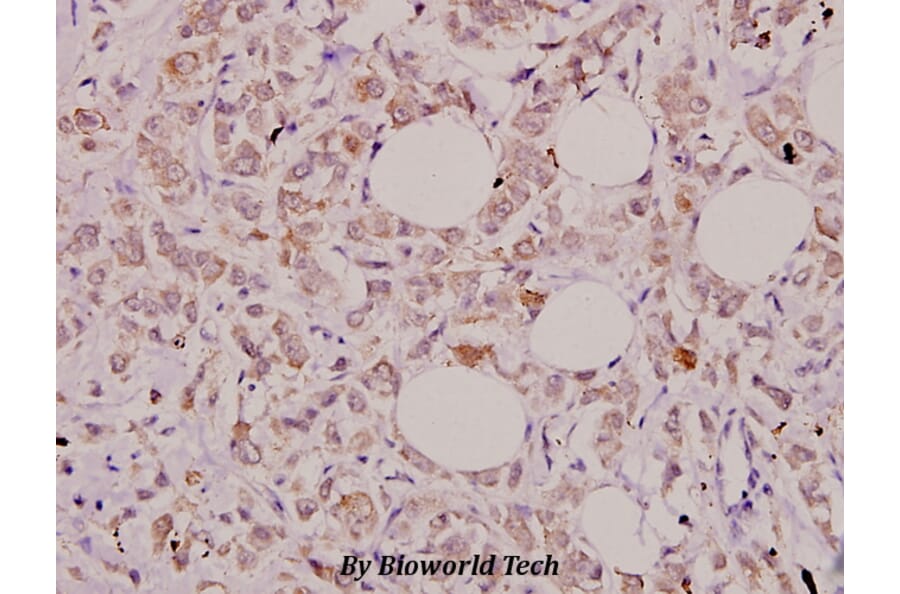 Anti-IL-32 (K226) Antibody from Bioworld Technology (BS3676) - Antibodies.com