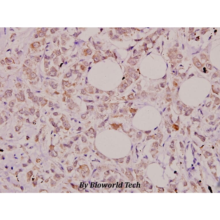Anti-IL-32 (K226) Antibody from Bioworld Technology (BS3676) - Antibodies.com