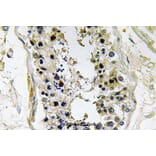 Anti-BMP-8 (E90) Antibody from Bioworld Technology (BS3677) - Antibodies.com