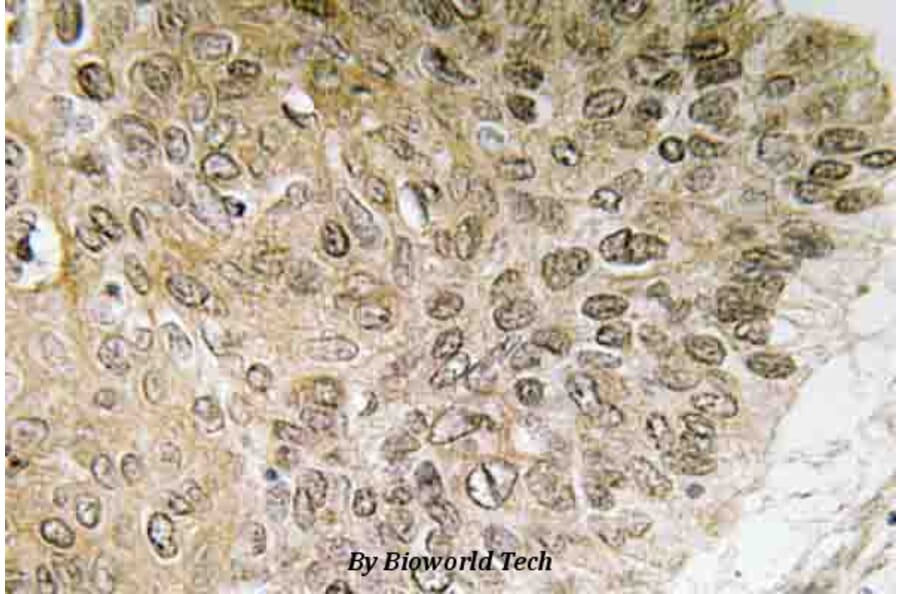 Anti-PI3K p85α (Q498) Antibody from Bioworld Technology (BS3678) - Antibodies.com