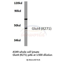 Anti-Glut 4 (R271) Antibody from Bioworld Technology (BS3680) - Antibodies.com