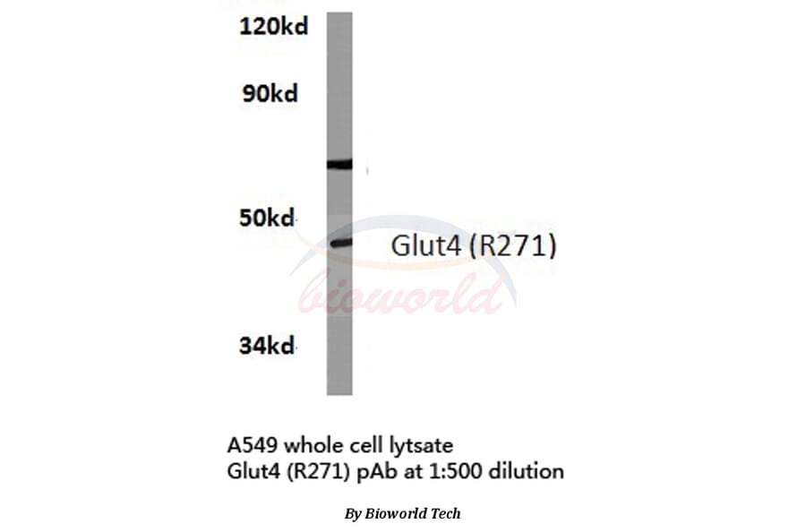 Anti-Glut 4 (R271) Antibody from Bioworld Technology (BS3680) - Antibodies.com