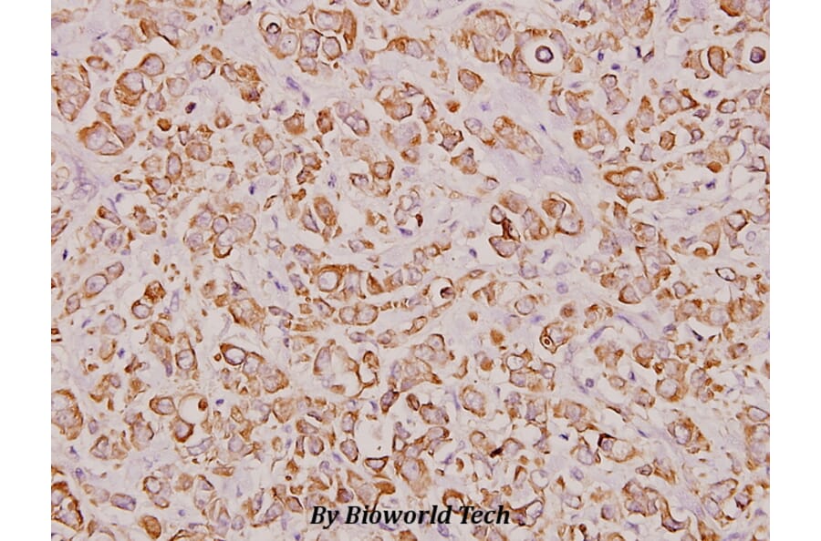 Anti-Glut 4 (R271) Antibody from Bioworld Technology (BS3680) - Antibodies.com