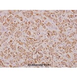 Anti-Glut 4 (R271) Antibody from Bioworld Technology (BS3680) - Antibodies.com