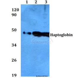 Anti-Haptoglobin (V328) Antibody from Bioworld Technology (BS3681) - Antibodies.com