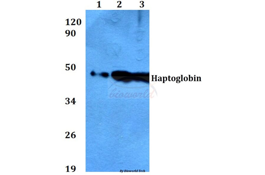 Anti-Haptoglobin (V328) Antibody from Bioworld Technology (BS3681) - Antibodies.com