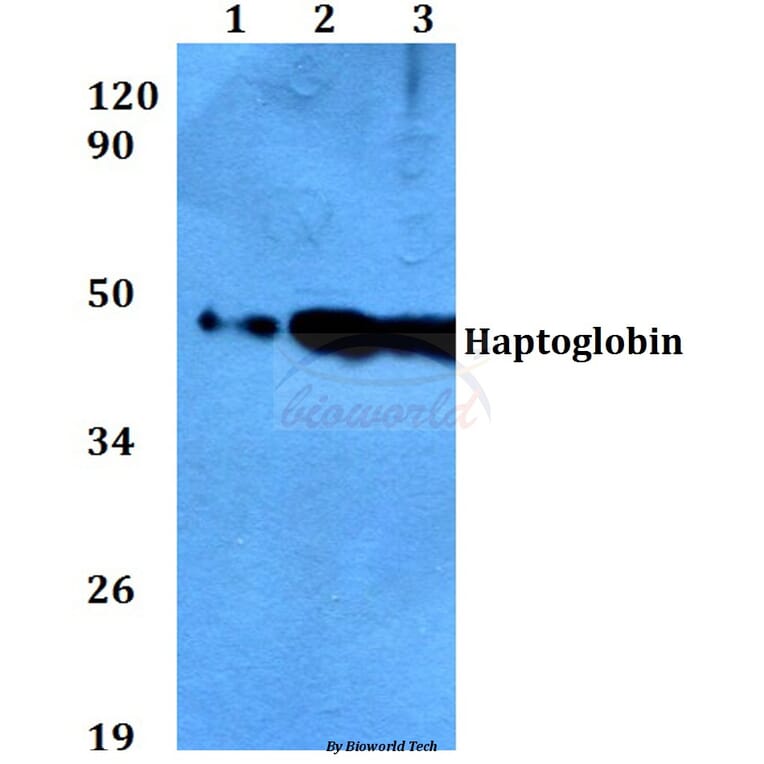 Anti-Haptoglobin (V328) Antibody from Bioworld Technology (BS3681) - Antibodies.com