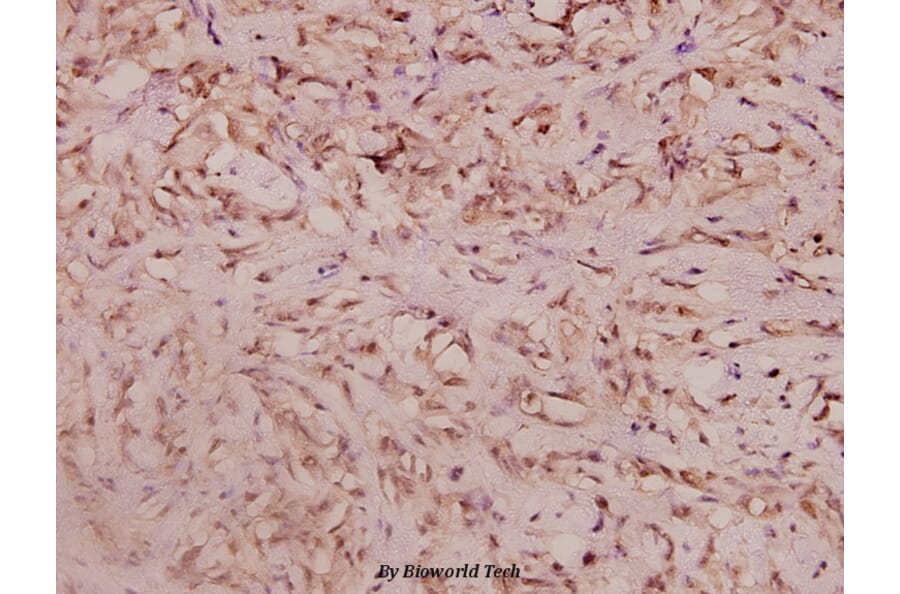 Anti-Haptoglobin (V328) Antibody from Bioworld Technology (BS3681) - Antibodies.com