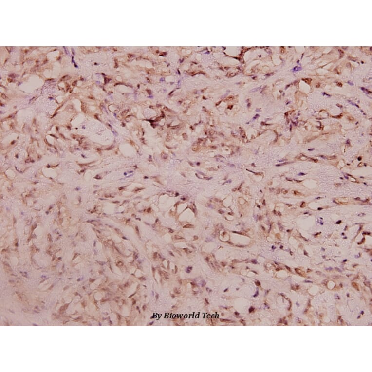 Anti-Haptoglobin (V328) Antibody from Bioworld Technology (BS3681) - Antibodies.com