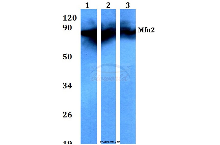 Anti-Mfn2 (F403) Antibody from Bioworld Technology (BS3682) - Antibodies.com
