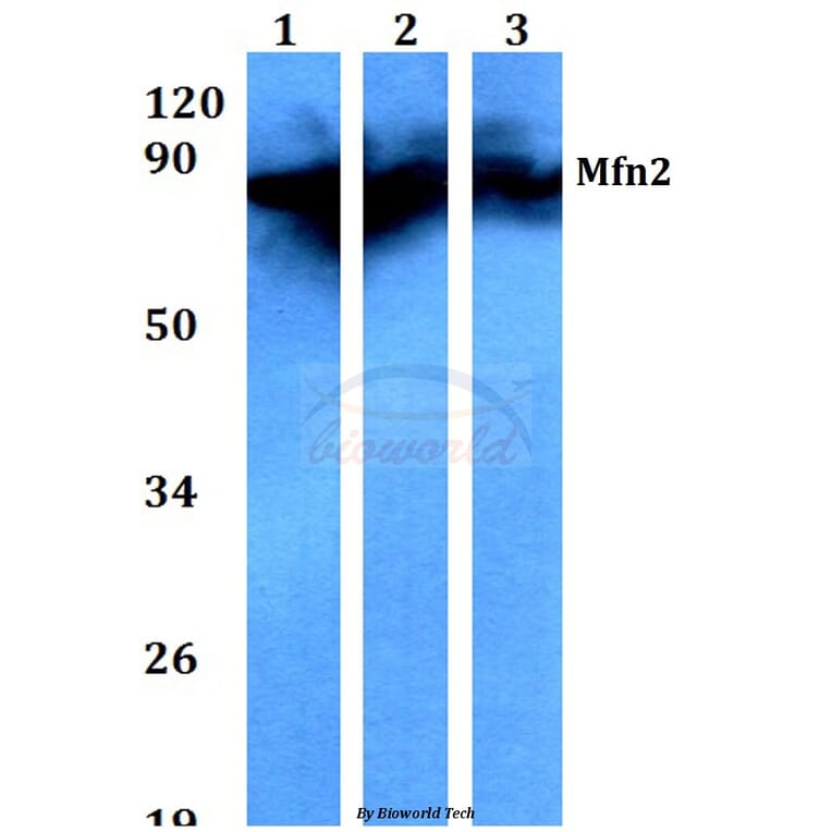 Anti-Mfn2 (F403) Antibody from Bioworld Technology (BS3682) - Antibodies.com