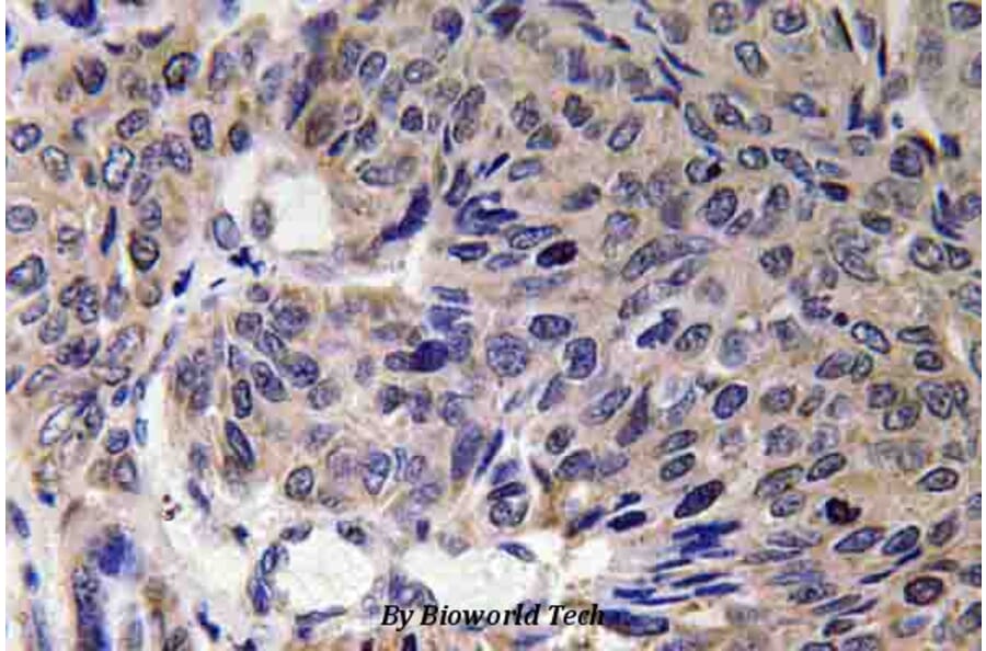 Anti-Mfn2 (F403) Antibody from Bioworld Technology (BS3682) - Antibodies.com