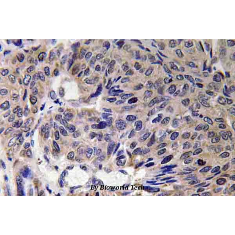 Anti-Mfn2 (F403) Antibody from Bioworld Technology (BS3682) - Antibodies.com