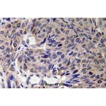 Anti-Mfn2 (F403) Antibody from Bioworld Technology (BS3682) - Antibodies.com