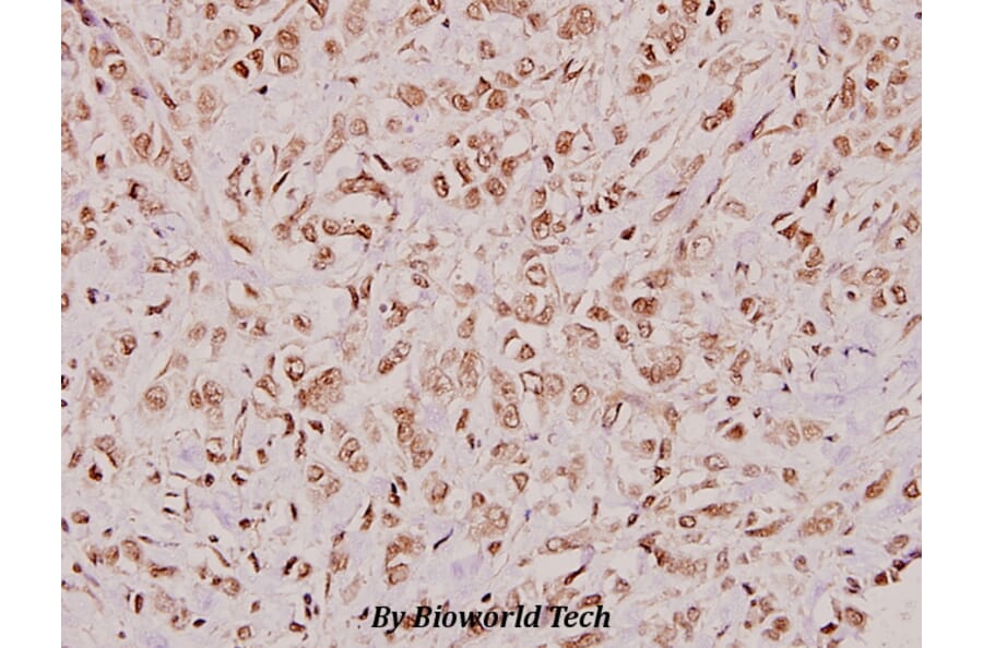 Anti-BMP-3 (E306) Antibody from Bioworld Technology (BS3683) - Antibodies.com