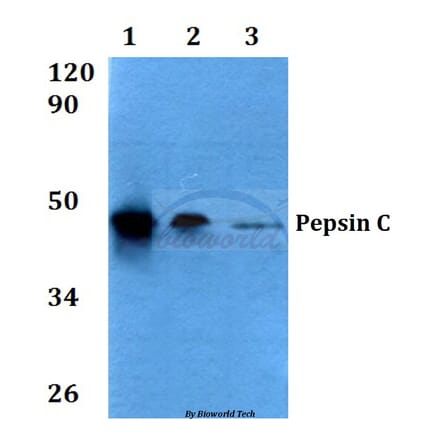 Anti-Pepsin C (F306) Antibody from Bioworld Technology (BS3685) - Antibodies.com