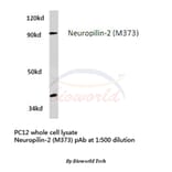Anti-Neuropilin-2 (M373) Antibody from Bioworld Technology (BS3687) - Antibodies.com