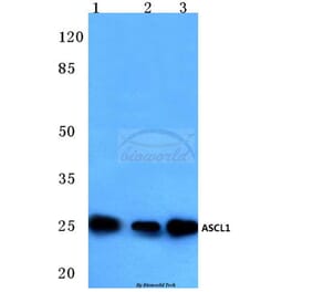 Anti-ASCL1 (E158) Antibody from Bioworld Technology (BS3688) - Antibodies.com