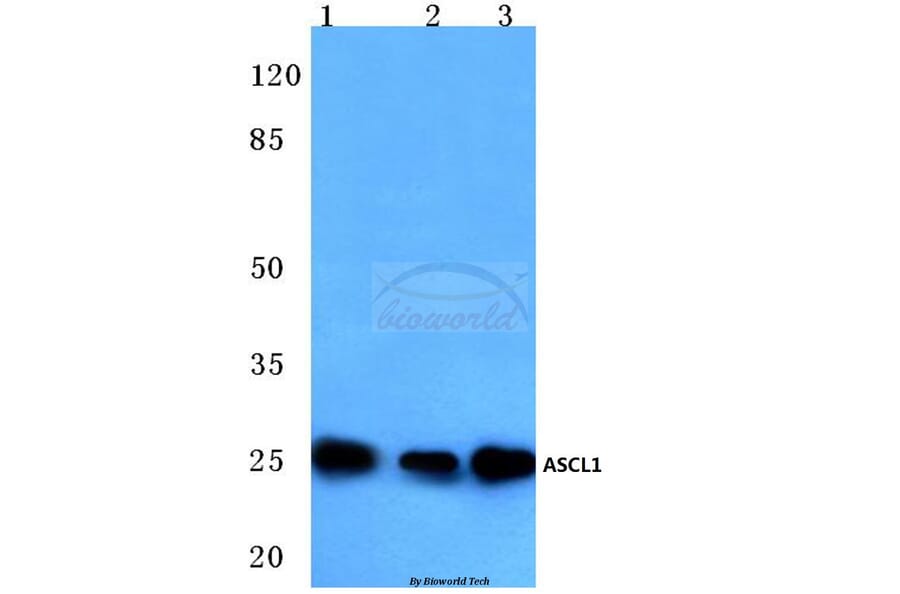 Anti-ASCL1 (E158) Antibody from Bioworld Technology (BS3688) - Antibodies.com