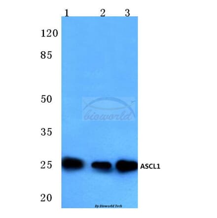 Anti-ASCL1 (E158) Antibody from Bioworld Technology (BS3688) - Antibodies.com
